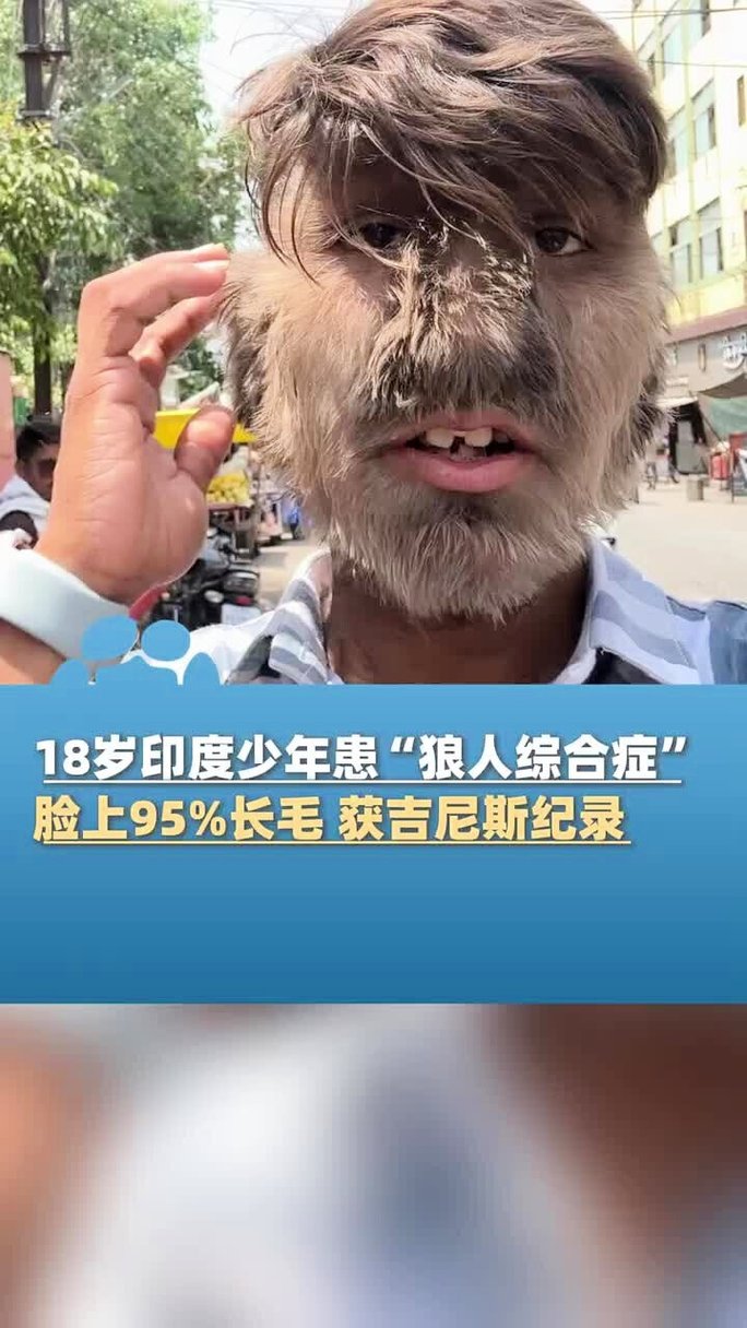 99国产精品99久久久久久娜娜的相关介绍